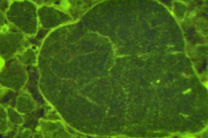  Fig. 6b: ... around aggregate particles contained in the concrete 