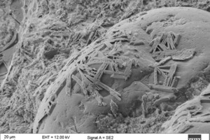  REM-Aufnahmen einer Gesteinskornoberfläche mit Anreicherungen von Calciumhydroxid (a) und Ettringit (b) in der Kontaktzone 
